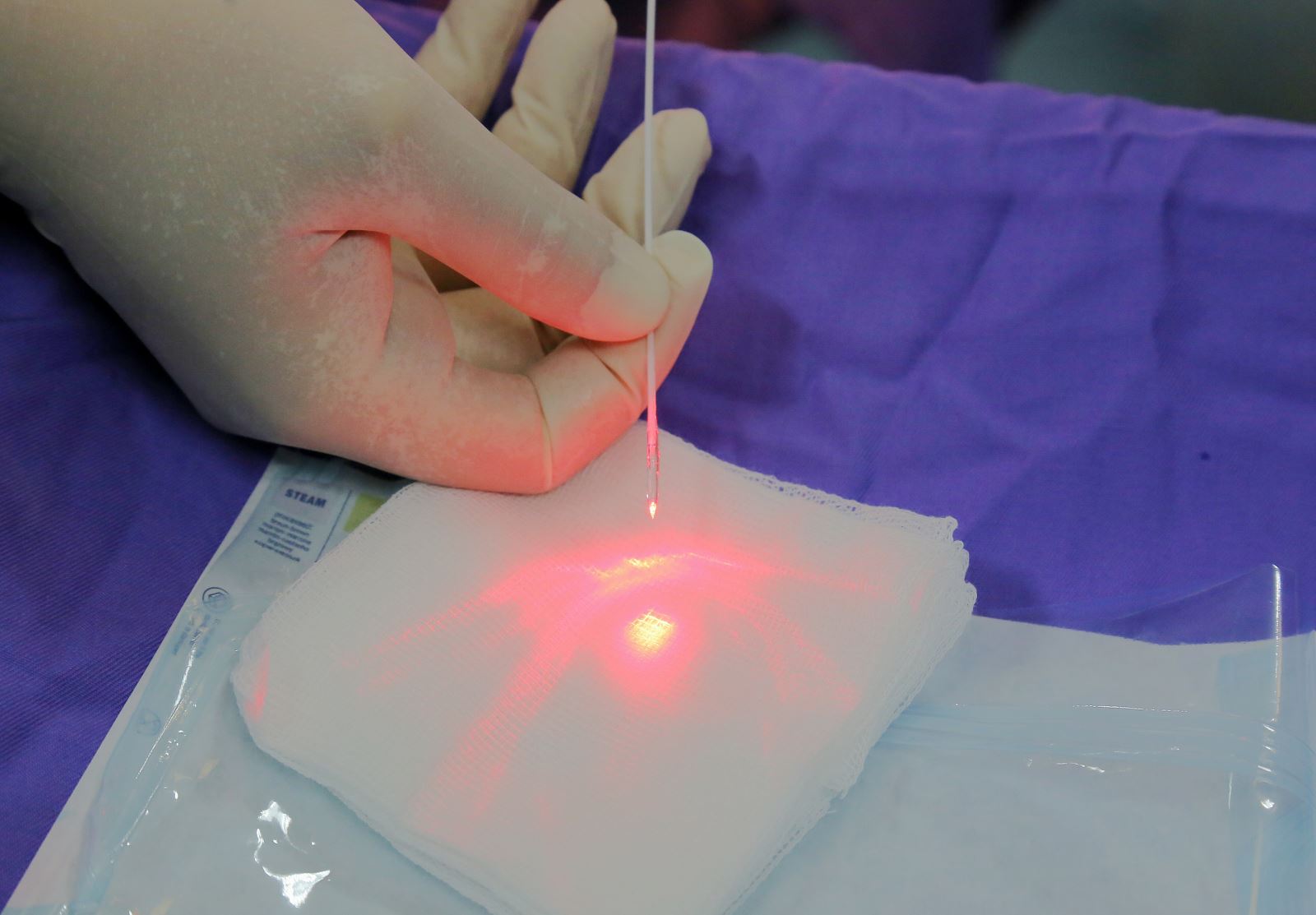 Vì sao nhiều người chọn phương pháp laser để điều trị trĩ tại Quy Nhơn?
